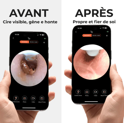 EARO VISION 2.0 - La solution recommandée par les ORL pour remplacer les cotons - tiges